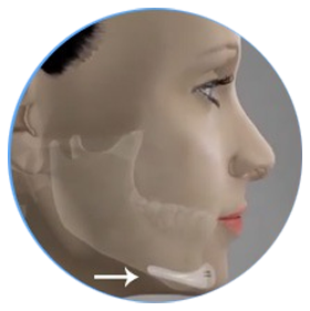 ĐỘN CẰM CHẤT LIỆU