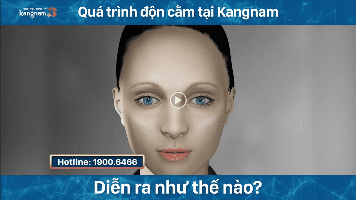 VIDEO quá trình độn cằm