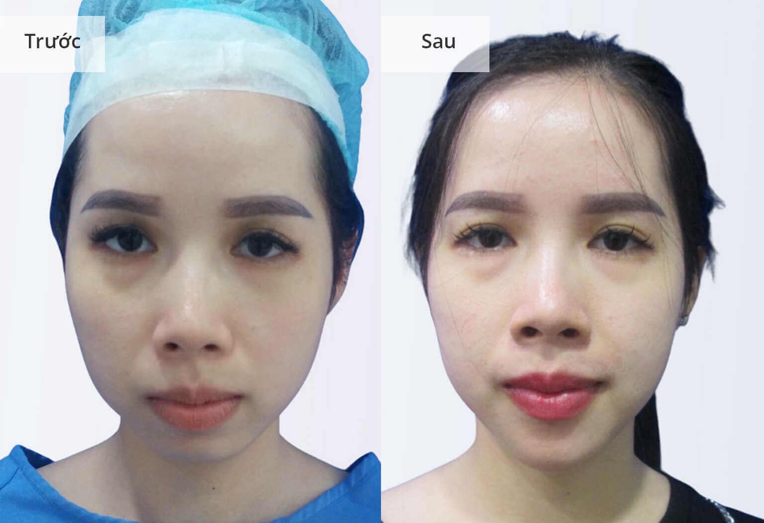 HÌNH ẢNH KHÁCH HÀNG