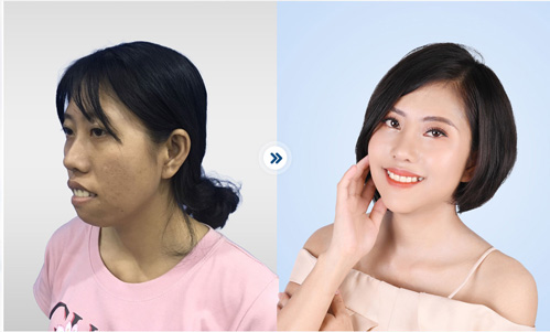 HÌNH ẢNH KHÁCH HÀNG