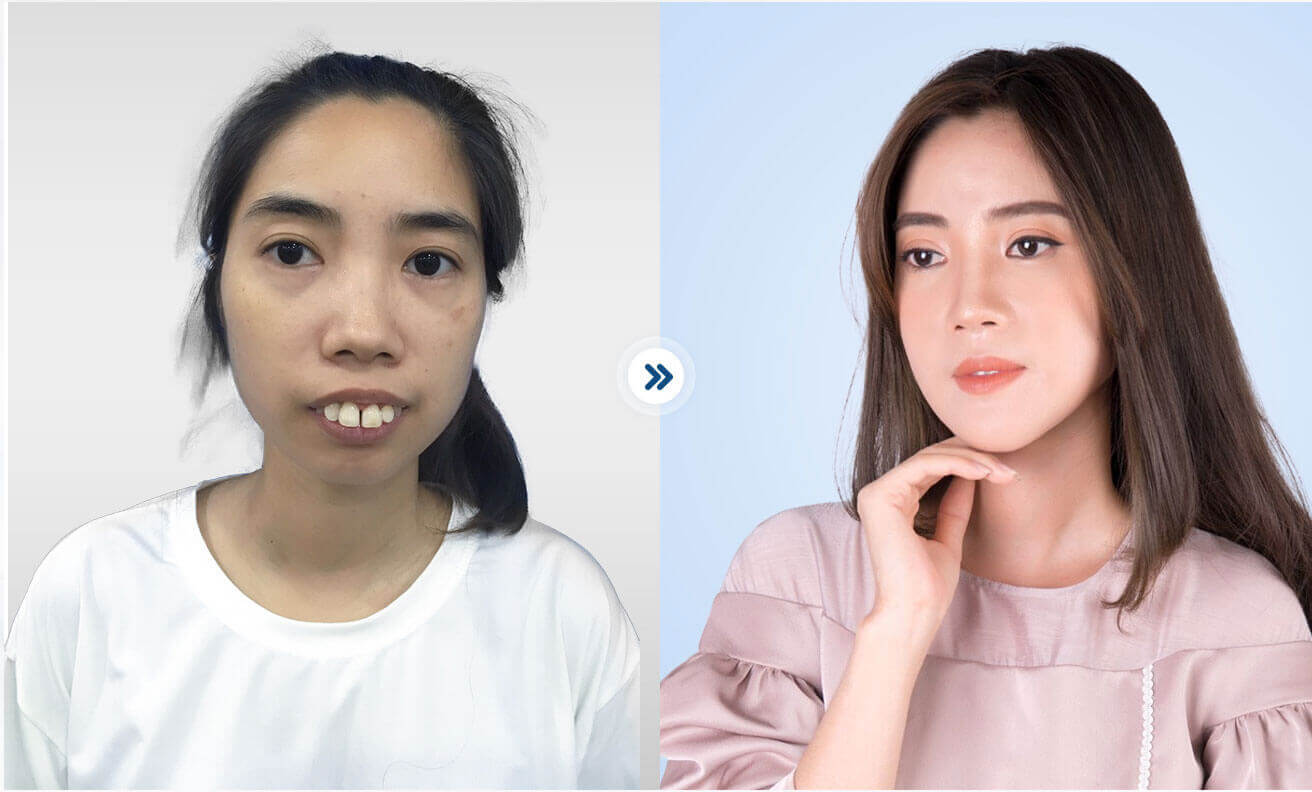 KH: Nguyễn Thị Huê