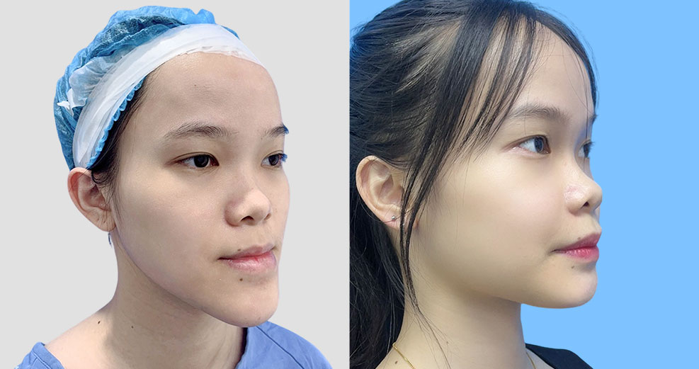 HÌNH ẢNH KHÁCH HÀNG