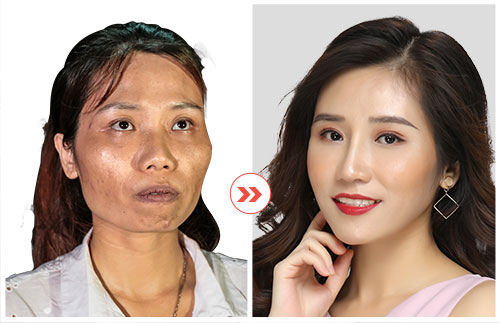 hình ảnh khách hàng