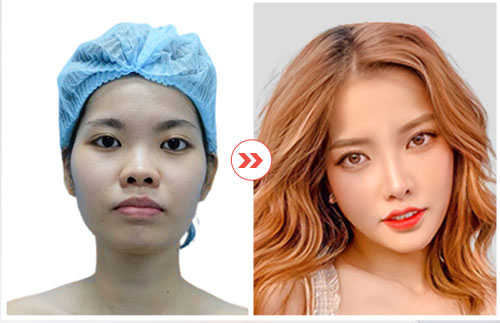 hình ảnh khách hàng