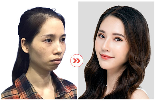 hình ảnh khách hàng