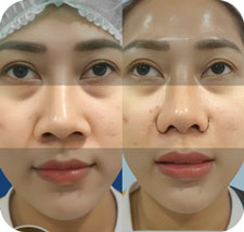 KẾT QUẢ KHÁCH HÀNG