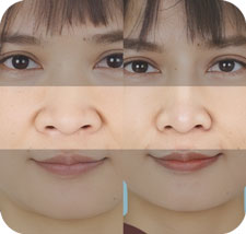 KẾT QUẢ KHÁCH HÀNG