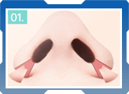 CÁC BƯỚC THU GỌN CÁNH MŨI