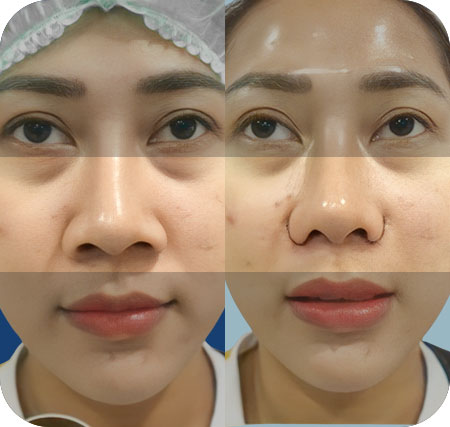 KẾT QUẢ KHÁCH HÀNG