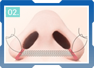 CÁC BƯỚC THU GỌN CÁNH MŨI