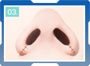 CÁC BƯỚC THU GỌN CÁNH MŨI