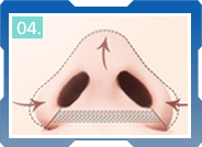 CÁC BƯỚC THU GỌN CÁNH MŨI