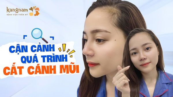 VIDEO THU GỌN CÁNH MŨI