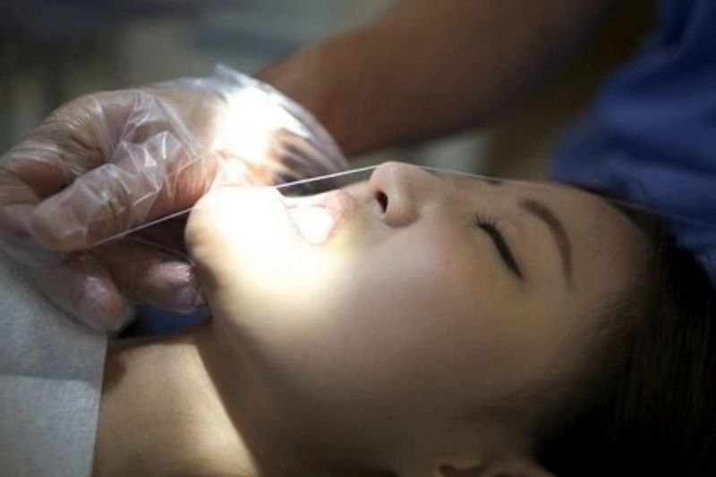 Gọt cằm có thể gây biến chứng nếu thực hiện sai kỹ thuật