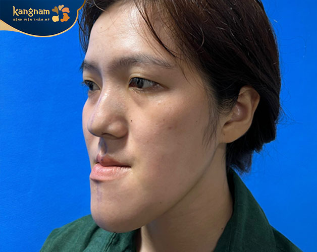Nhận biết mặt lưỡi cày