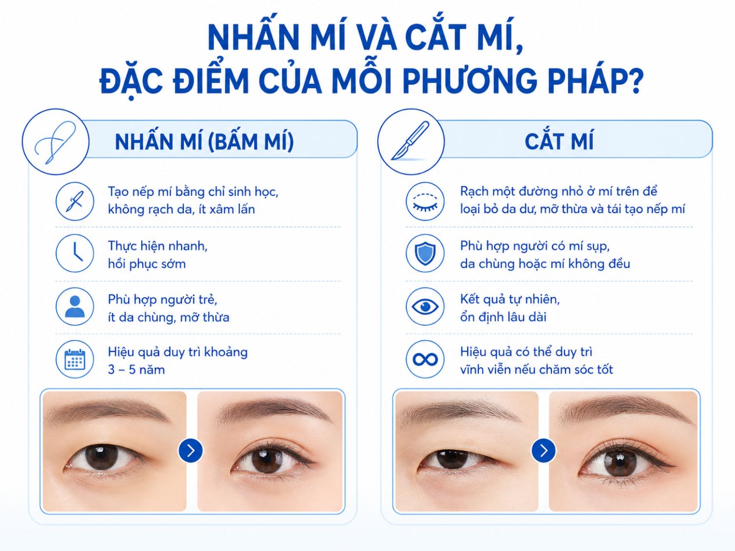 Phân biệt nhấn mí (ít xâm lấn, hồi phục nhanh, phù hợp người trẻ) và cắt mí (loại bỏ da chùng, mỡ thừa, hiệu quả lâu dài)