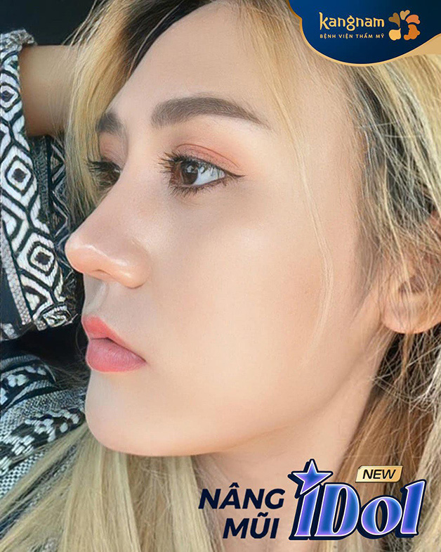 Sống mũi cao thẳng, thon gọn, tạo đường nét sang trọng và cuốn hút