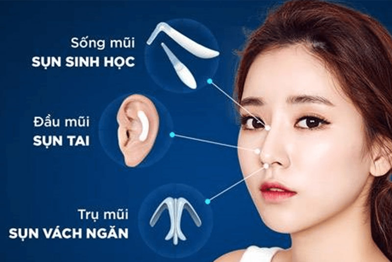 Nâng mũi cấu trúc tạo hình mũi toàn diện