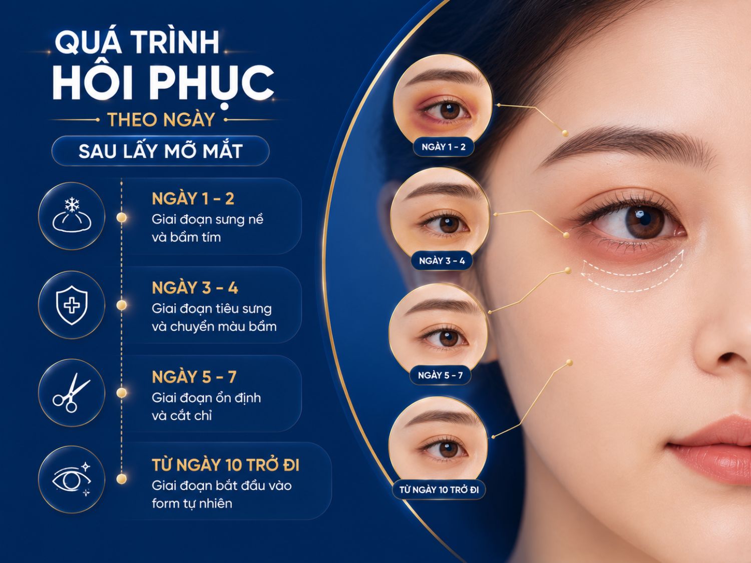 Sau lấy mỡ mắt, vùng mí thường trải qua các giai đoạn sưng, bầm và ổn định theo từng mốc thời gian. Việc chăm sóc đúng hướng dẫn giúp quá trình hồi phục diễn ra thuận lợi và kết quả tự nhiên hơn.
