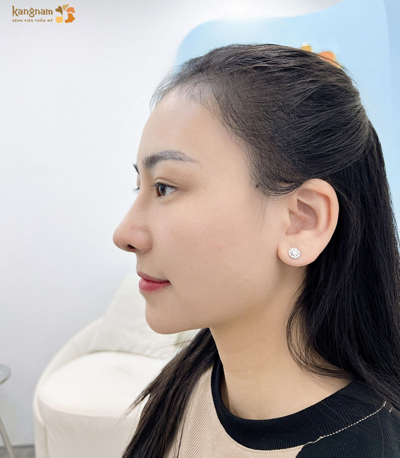 Mũi vào form ổn định