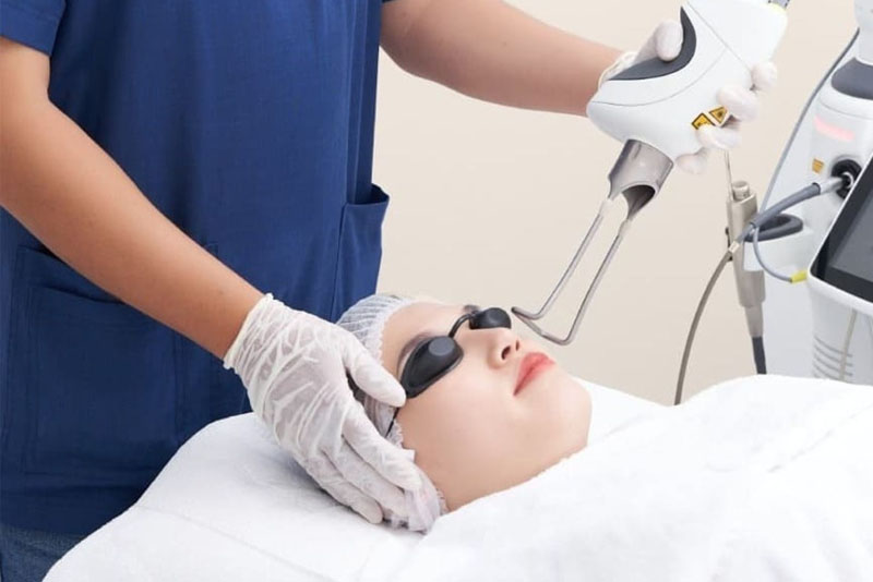 Trị tàn nhang tận gốc bằng tia laser