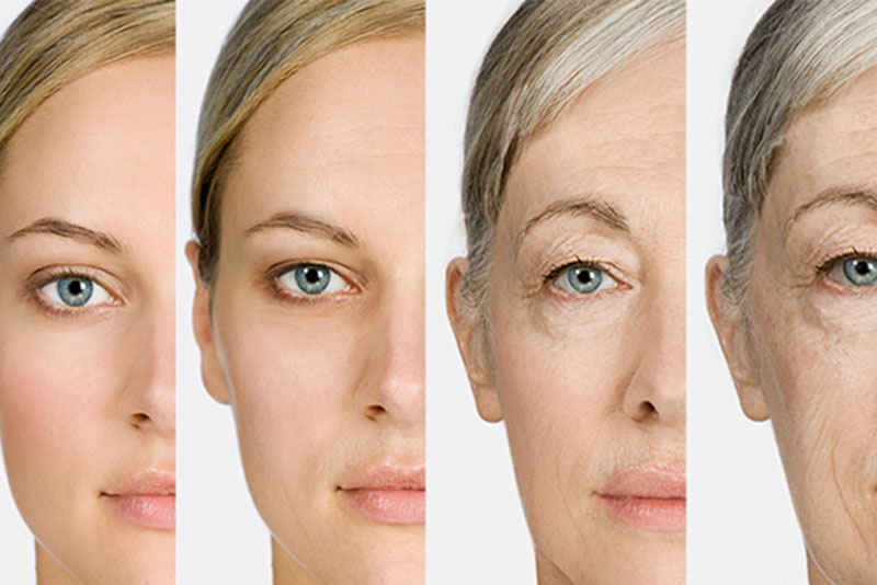 Da vẫn sẽ lão hóa theo thời gian, ngay cả khi không tiêm botox