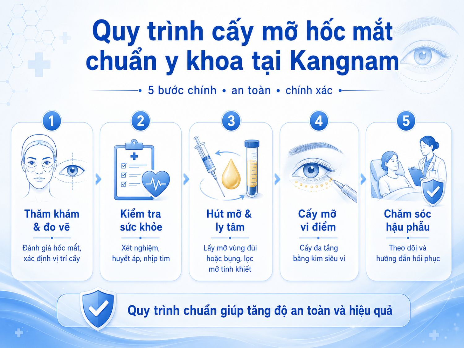 Quy trình cấy mỡ hốc mắt chuẩn y khoa thường bao gồm 5 bước từ thăm khám, kiểm tra sức khỏe đến cấy mỡ và theo dõi hậu phẫu.