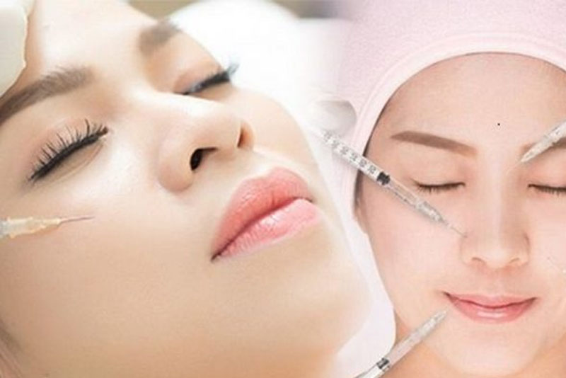 Tiêm tan filler là phương pháp thực hiện sau tiêm filler