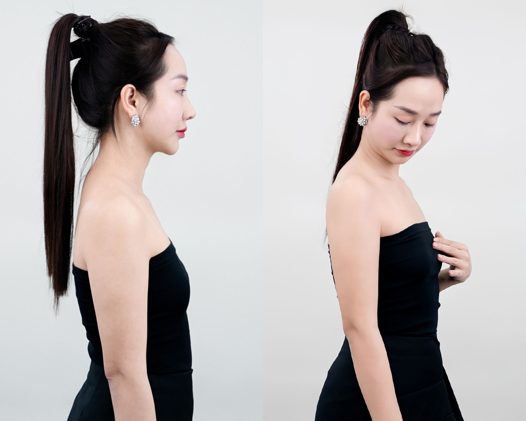 Ngực lép và thiếu hụt mô ngực nên cân nhắc đặt túi độn