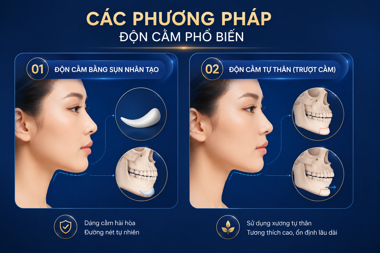 ảnh mô tả Các phương pháp độn cằm phổ biến là độn cằm vật liệu và trượt cằm