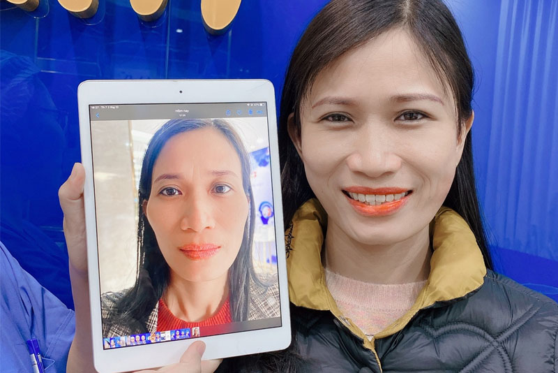 khách hàng hài lòng sau khi làm độn thái dương ở Kangnam