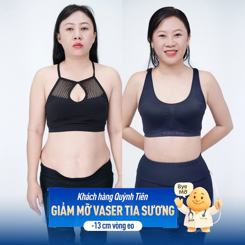 Lựa chọn hút mỡ tại cơ sở thẩm mỹ uy tín để đảm bảo an toàn