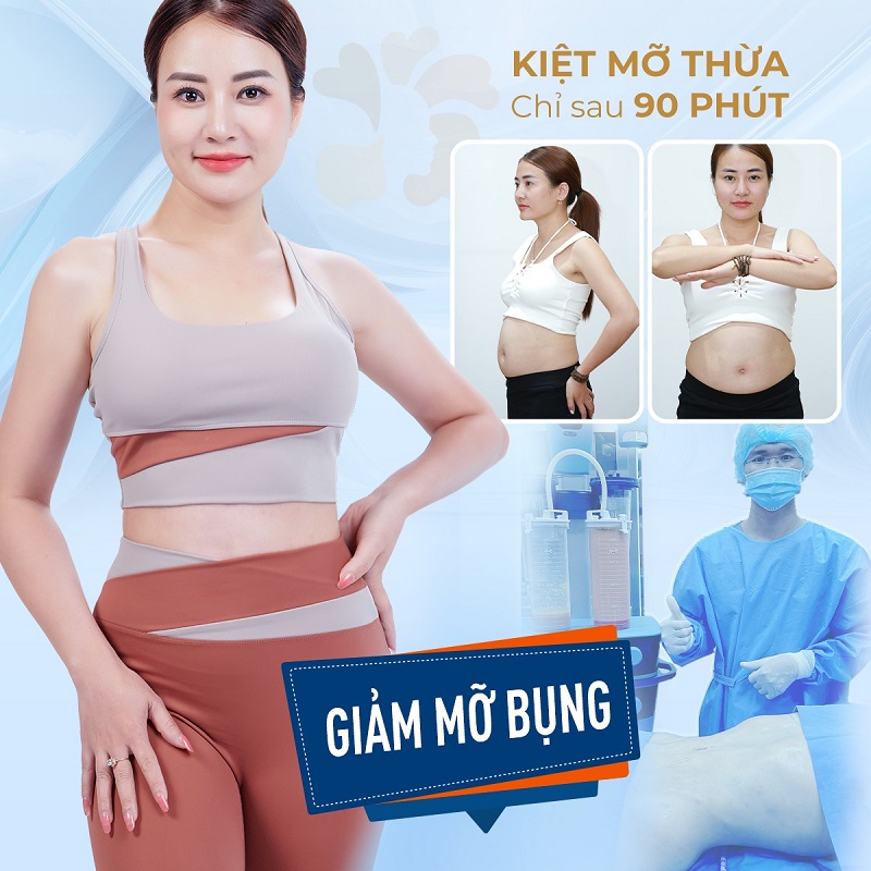 Thời gian hút mỡ diễn ra nhanh chóng, đảm bảo an toàn