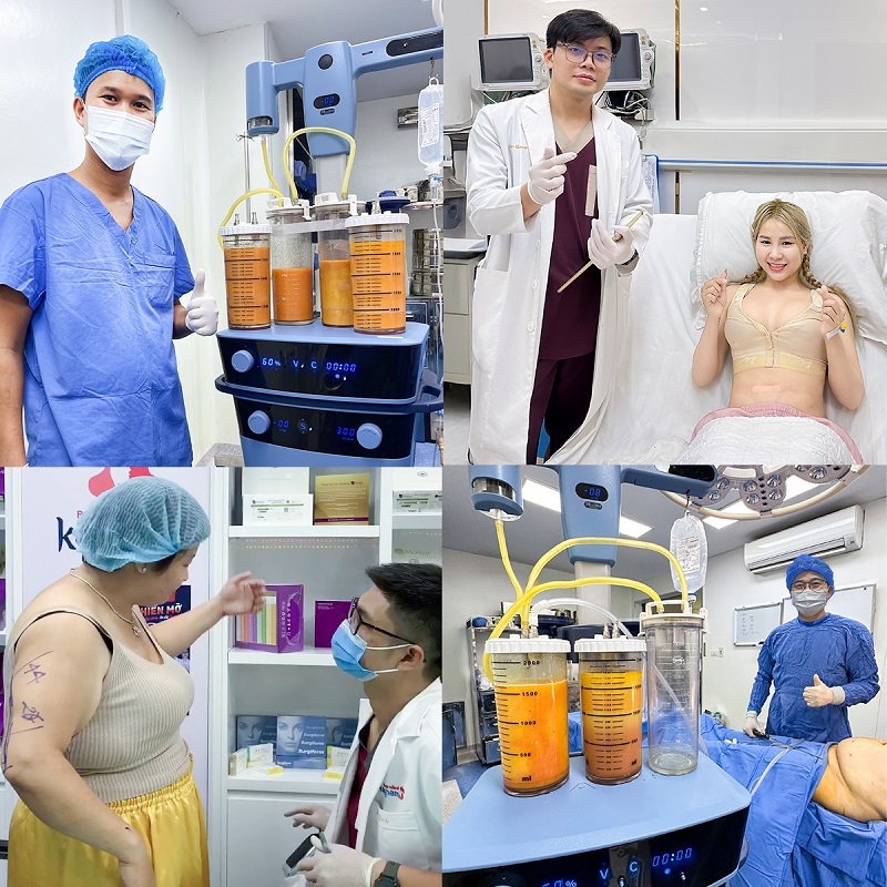 Giảm mỡ Lipo 360 loại bỏ mỡ thừa nhanh chóng và an toàn