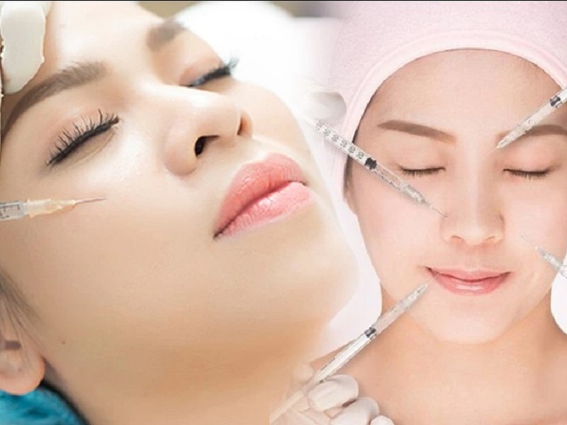 Tiêm filler đưa hoạt chất HA vào da mặt giúp làm đầy và cải thiện kết cấu da