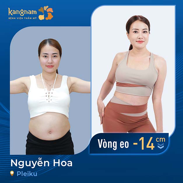 Giảm mỡ giúp phái đẹp lấy lại vóc dáng tự tin