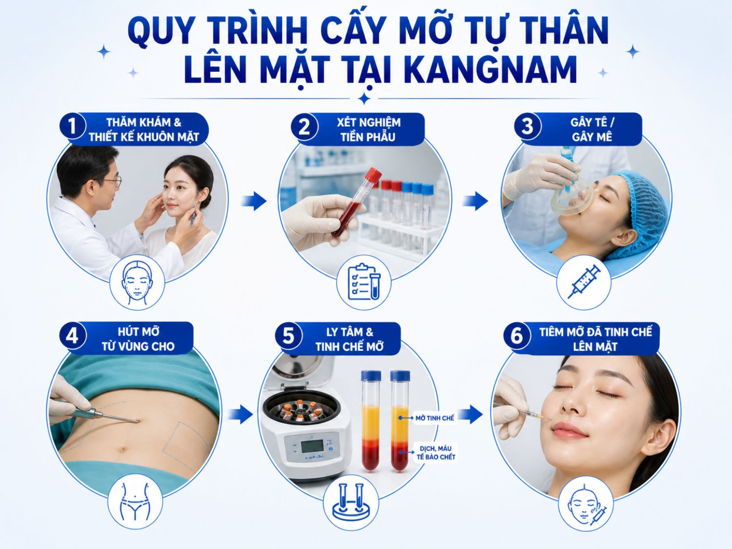 6 bước cấy mỡ tự thân chuẩn y khoa giúp đảm bảo an toàn và tăng tỷ lệ mỡ sống lâu dài
