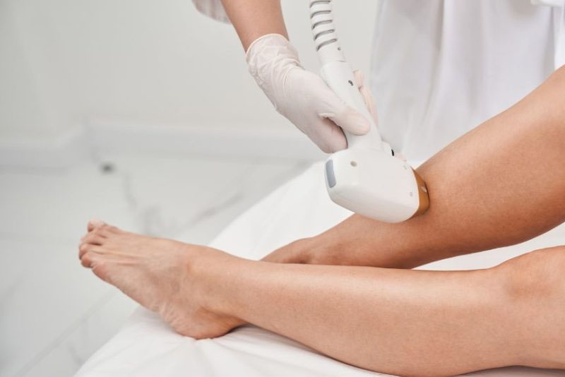 Triệt lông vĩnh viễn bằng laser hay IPL không phù hợp với tuổi 15