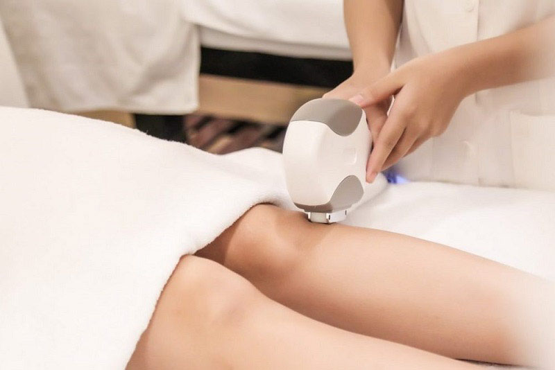 Mang thai không nên triệt lông bằng laser