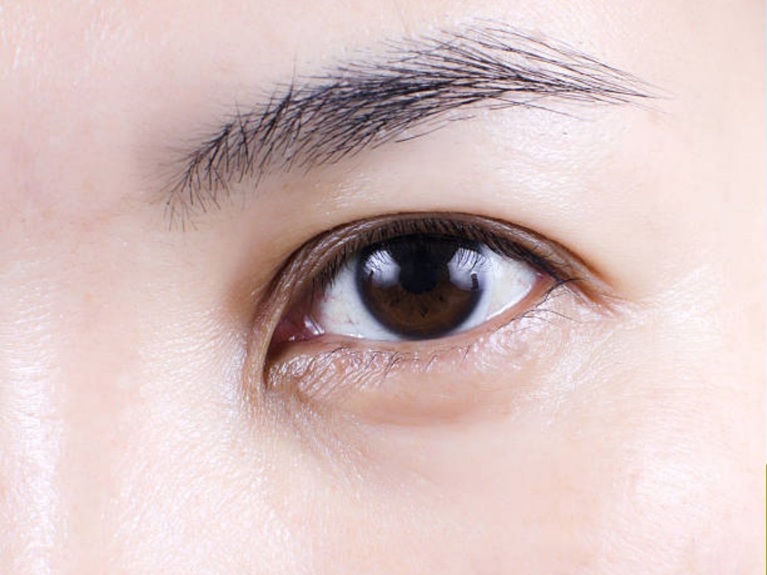 Độ mở của cung mắt và trương lực cơ nâng mi quyết định kích thước mí
