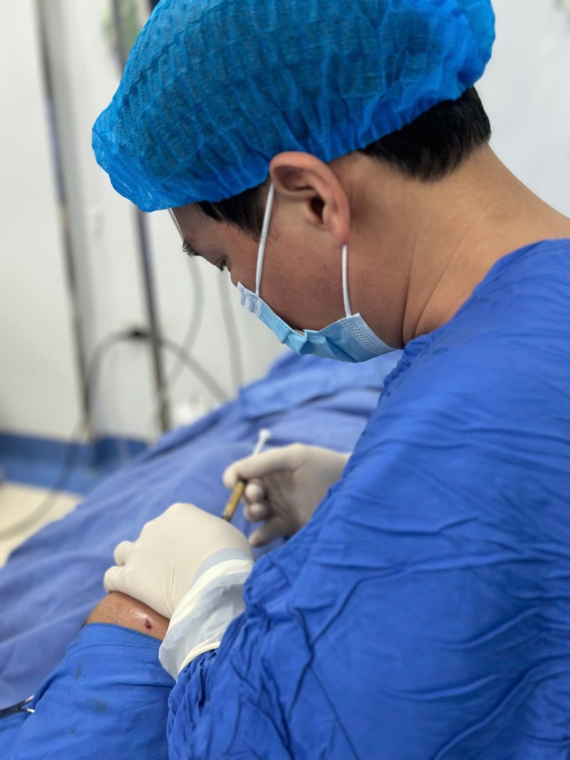 Thời gian duy trì lâu dài hay không cũng tùy thuộc vào tay nghề của bác sĩ thực hiện