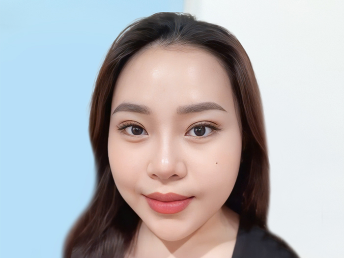 Tuân thủ đúng cách chăm sóc của bác sĩ, chế độ dinh dưỡng khoa học giúp khách hàng của Kangnam sở hữu nếp mí cân đối, tự nhiên