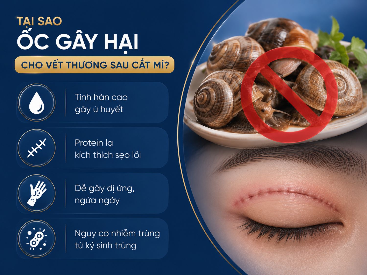 Ốc là thực phẩm thường được khuyến cáo hạn chế trong giai đoạn đầu sau cắt mí do có thể làm tăng nguy cơ ngứa ngáy, dị ứng và ảnh hưởng đến quá trình lành thương của vùng mí mắt.