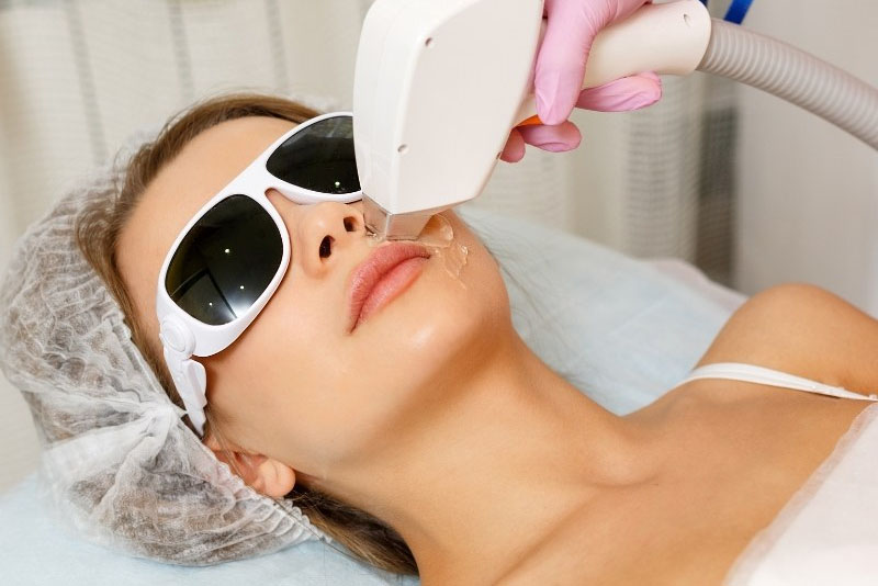 liệu trình triệt lông bằng laser hoặc IPL thường kéo dài từ 3-8 buổi