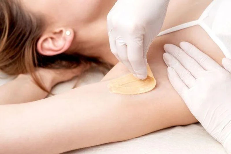 Không wax lông nách sau khi triệt lông laser