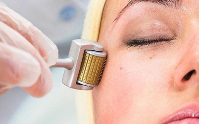 Lăn kim có tác dụng tạo tổn thương giả, để kích thích da sản sinh collagen