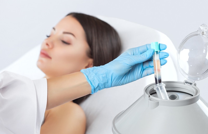 Công nghệ PRP sử dụng huyết tương của khách hàng