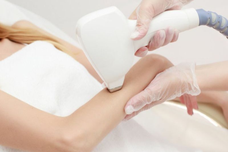 Phương pháp triệt lông bằng công nghệ như laser diode hoặc IPL ức chế lông phát triển