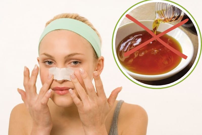 Hạn chế nước mắm sau nâng mũi giúp giảm sưng viêm