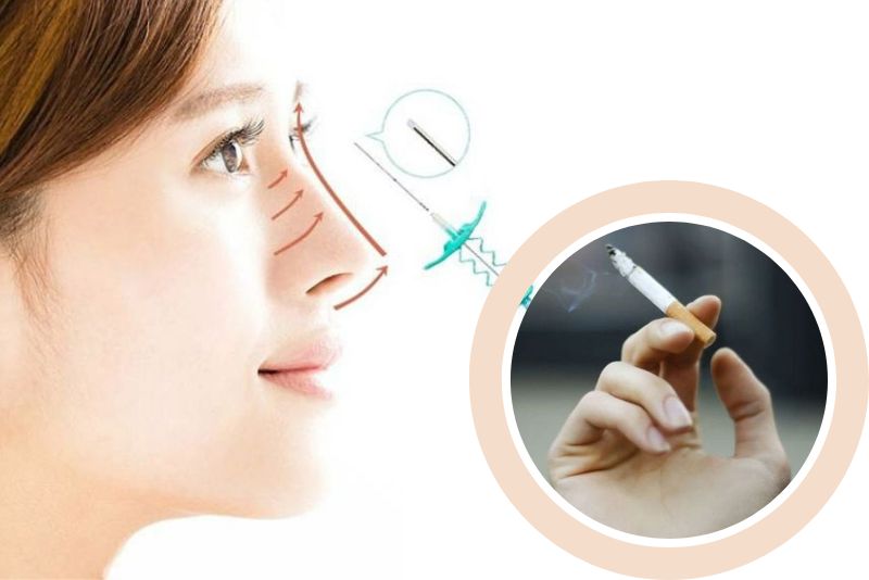 Nâng mũi chỉ tuyệt đối không hút thuốc lá